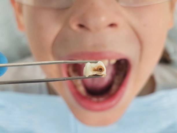 Best Same-Day Emergency Dental Services in Clarkston Heights Vineland, WA